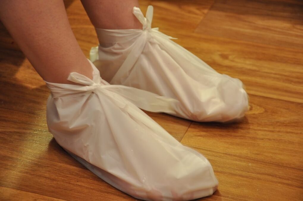 ayak bileği artrozu için kompresler