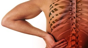 Lomber omurganın osteokondrozu kendini nasıl gösterir