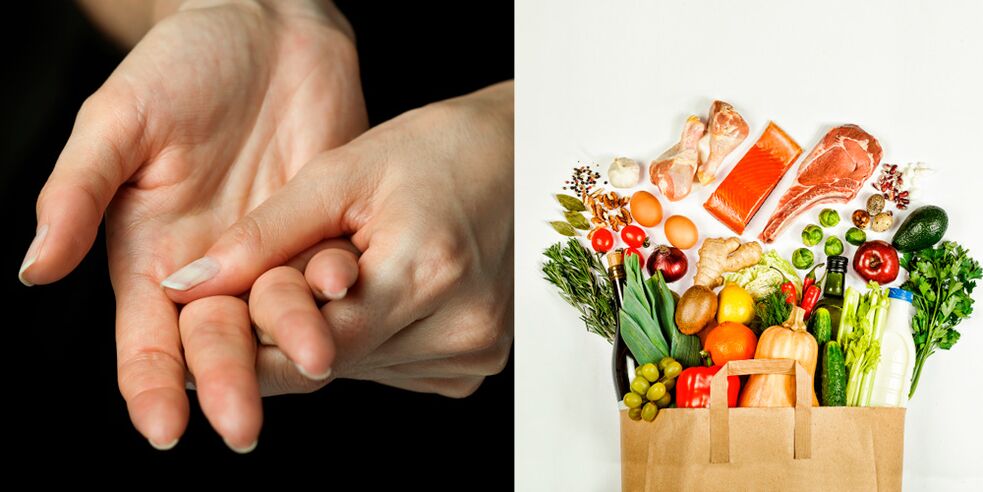 ellerin gut artriti ve tedavisi için yiyecekler