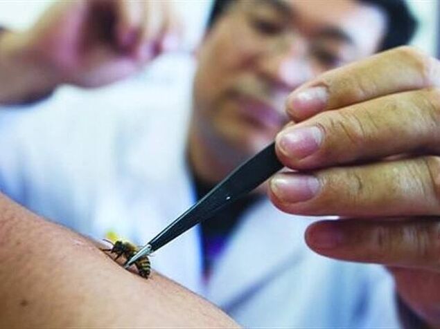 Servikal osteokondroz için apiterapi